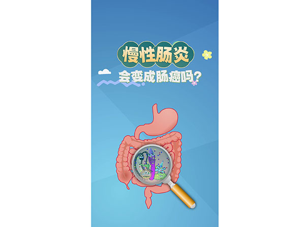 科普在線丨慢性腸炎會(huì)變成腸癌嗎？