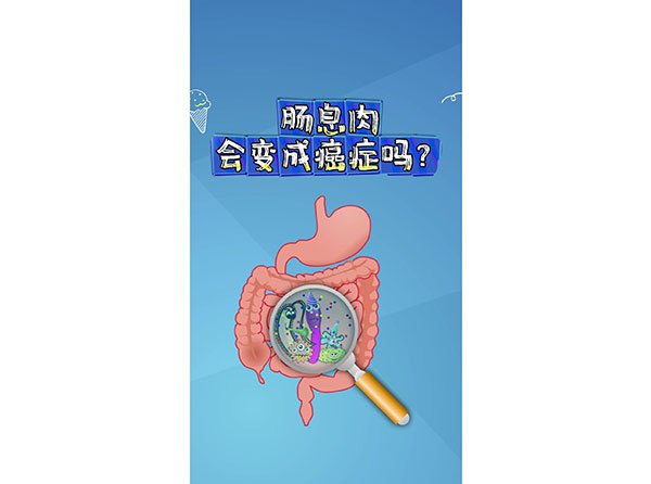 腸息肉會(huì)變成癌癥嗎？